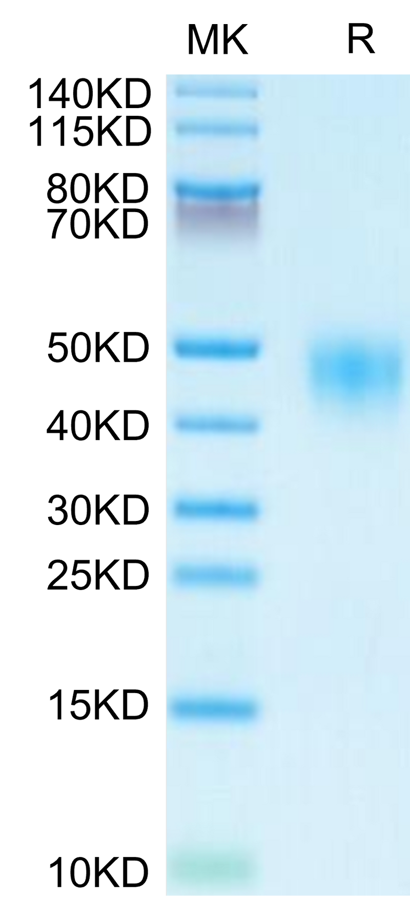 Human CD48 on Tris-Bis PAGE under reduced condition. The purity is greater than 95%.Recombinant Human CD48/SLAMF2 Protein, Active