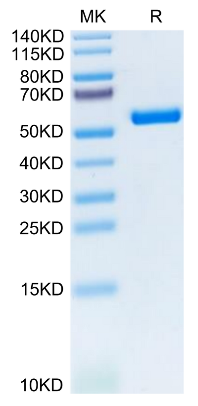 Biotinylated Human HLA-A*11:01&B2M&KRAS G12D (VVVGADGVGK) Monomer on Tris-Bis PAGE under reduced condition. The purity is greater than 95%.Biotinylated Human HLA-A*11:01&B2M&KRAS G12D (VVVGADGVGK) Monomer Protein, Active