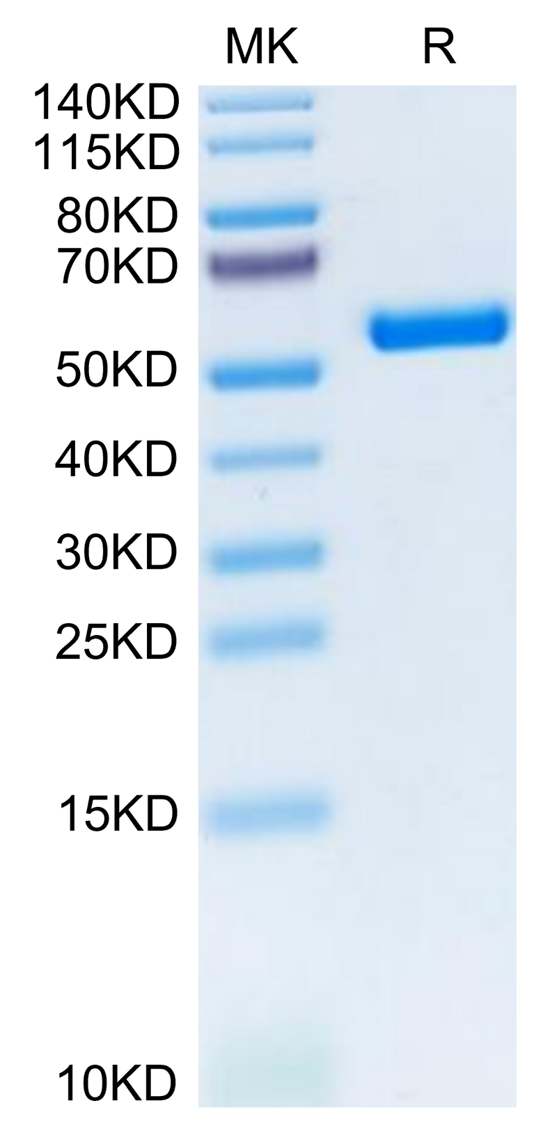Biotinylated Human HLA-A*11:01&B2M&KRAS G12D (VVVGADGVGK) Monomer on Tris-Bis PAGE under reduced condition. The purity is greater than 95%.Biotinylated Human HLA-A*11:01&B2M&KRAS G12D (VVVGADGVGK) Monomer Protein, Active