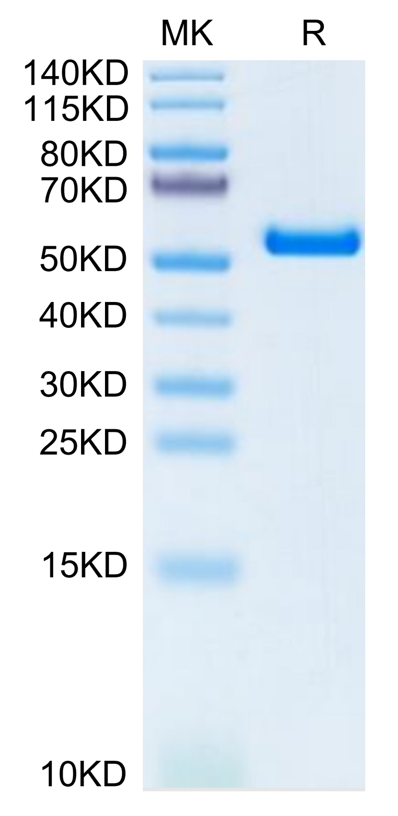 Biotinylated Human HLA-A*11:01&B2M&KRAS G12V (VVVGAVGVGK) Monomer on Tris-Bis PAGE under reduced condition. The purity is greater than 95%.Biotinylated Human HLA-A*11:01&B2M&KRAS G12V (VVVGAVGVGK) Monomer Protein