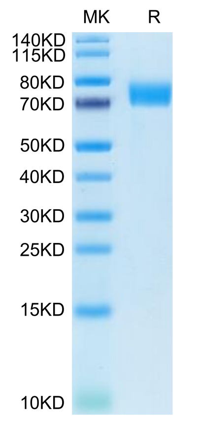 Human B7-H6 on Tris-Bis PAGE under reduced condition. The purity is greater than 95%.Recombinant Human B7-H6/NCR3LG1 Protein, Active