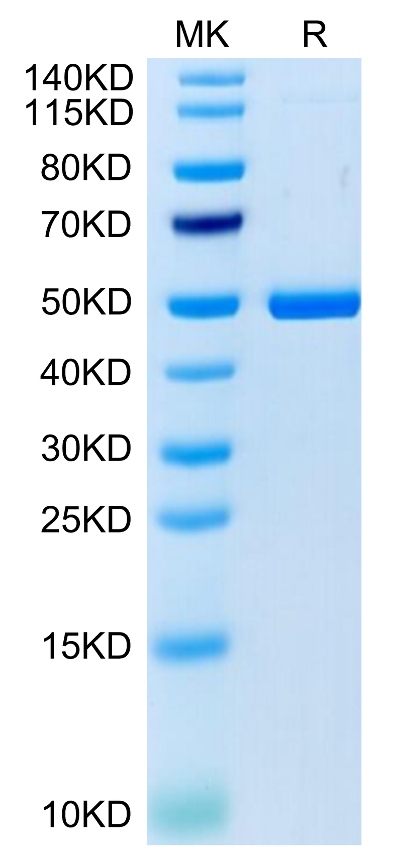 Cynomolgus 4-1BB Ligand on Tris-Bis PAGE under reduced condition. The purity is greater than 95%.Recombinant Cynomolgus 4-1BB Ligand/TNFSF9 Protein, Active