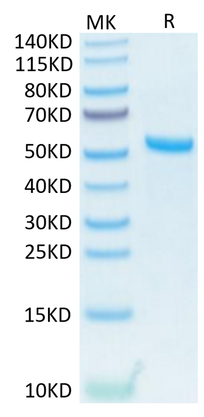 Human APRIL Trimer on Tris-Bis PAGE under reduced condition. The purity is greater than 95%.Recombinant Human APRIL/TNFSF13 Trimer Protein, Active