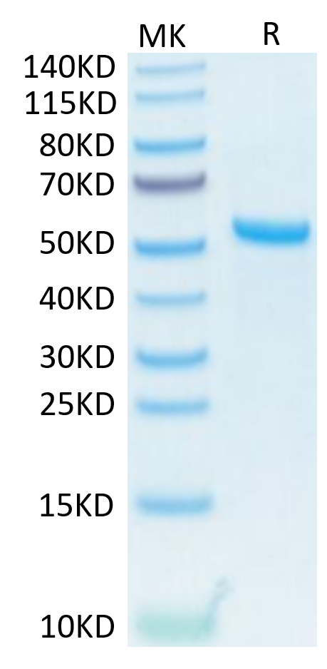 Human APRIL Trimer on Tris-Bis PAGE under reduced condition. The purity is greater than 95%.Recombinant Human APRIL/TNFSF13 Trimer Protein, Active