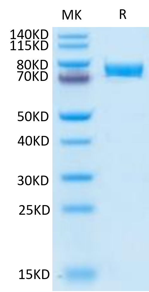 Human B7-H4 on Tris-Bis PAGE under reduced condition. The purity is greater than 95%.Recombinant Human B7-H4 Protein, Active