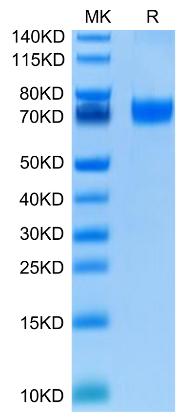 Human B7-H5 on Tris-Bis PAGE under reduced condition. The purity is greater than 95%.Recombinant Human B7-H5/Gi24/VISTA Protein, Active