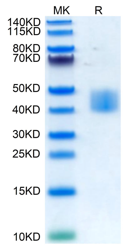 Human MSLN on Tris-Bis PAGE under reduced condition. The purity is greater than 95%.Recombinant Human MSLN/Mesothelin Protein, Active