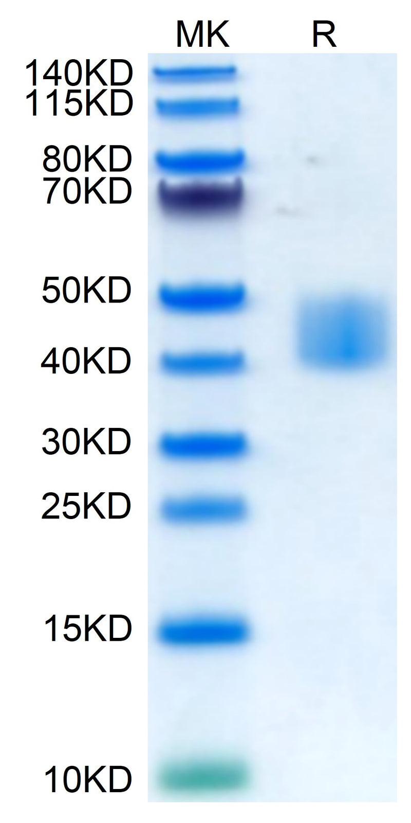 Human MSLN on Tris-Bis PAGE under reduced condition. The purity is greater than 95%.Recombinant Human MSLN/Mesothelin Protein, Active