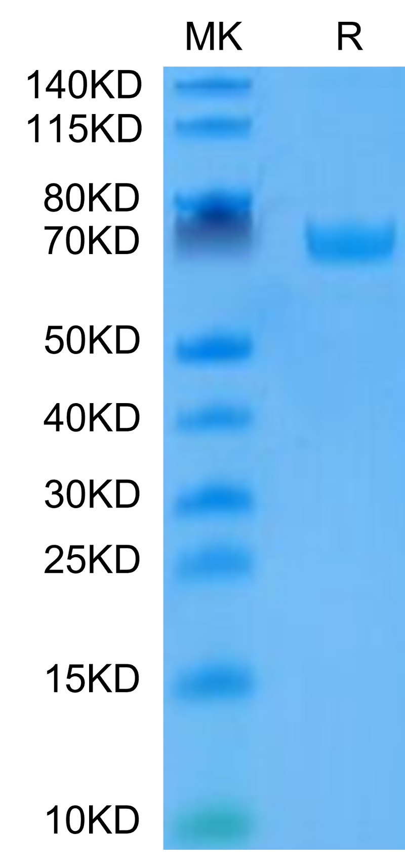 Human B7-H3 on Tris-Bis PAGE under reduced condition. The purity is greater than 95%.Recombinant Human B7-H3/CD276 Protein, Active