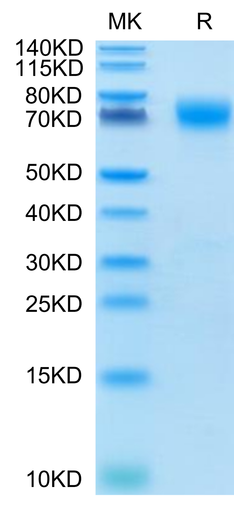 Cynomolgus B7-H3 on Tris-Bis PAGE under reduced condition. The purity is greater than 95%.Recombinant Cynomolgus B7-H3/CD276 Protein, Active