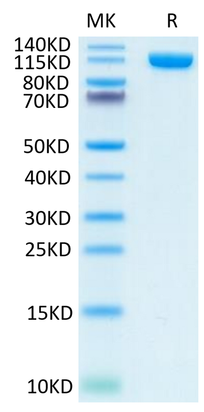 Human PSMA on Tris-Bis PAGE under reduced condition. The purity is greater than 95%.