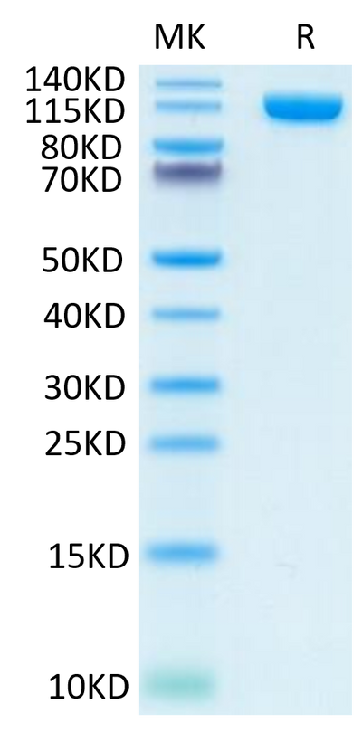Human PSMA on Tris-Bis PAGE under reduced condition. The purity is greater than 95%.Recombinant Human PSMA/FOLH1 Protein, Active