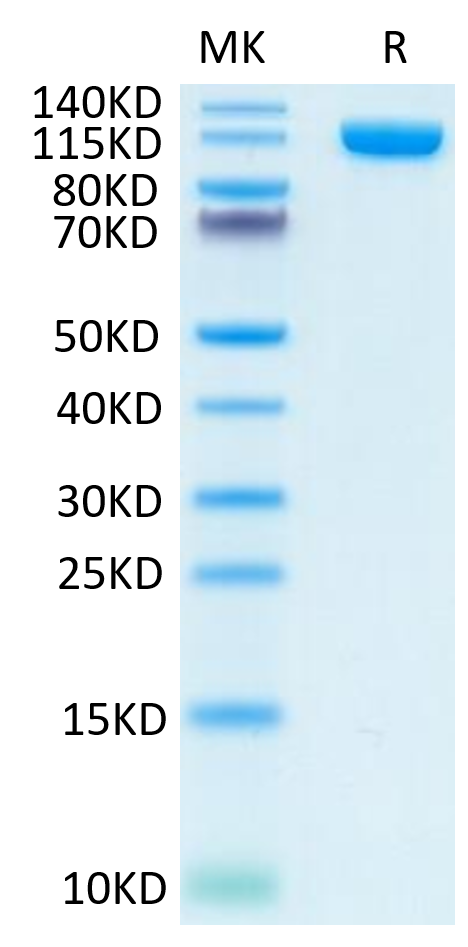 Human PSMA on Tris-Bis PAGE under reduced condition. The purity is greater than 95%.Recombinant Human PSMA/FOLH1 Protein, Active