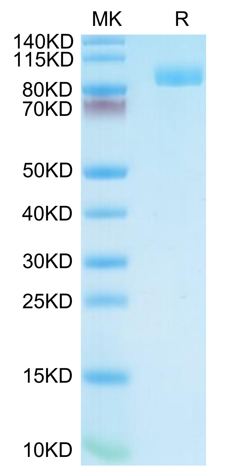Cynomolgus PSMA on Tris-Bis PAGE under reduced condition. The purity is greater than 95%.Recombinant Cynomolgus PSMA/FOLH1 Protein, Active