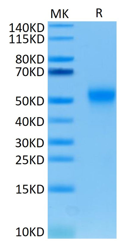 Human TIM-3 on Tris-Bis PAGE under reduced condition. The purity is greater than 95%.Recombinant Human Tim-3/HAVCR2 Protein, Active