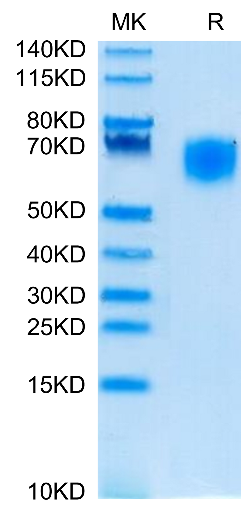 Cynomolgus SIRP alpha on Tris-Bis PAGE under reduced condition. The purity is greater than 95%.Recombinant Cynomolgus SIRP alpha/CD172a Protein, Active