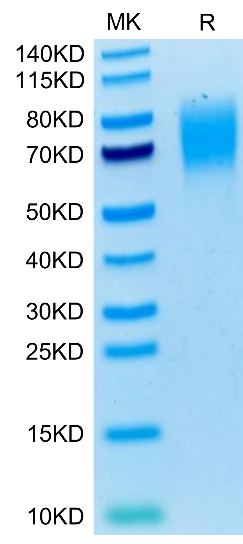 Mouse SIRP alpha on Tris-Bis PAGE under reduced condition. The purity is greater than 95%.Recombinant Mouse SIRP alpha/CD172a Protein, Active