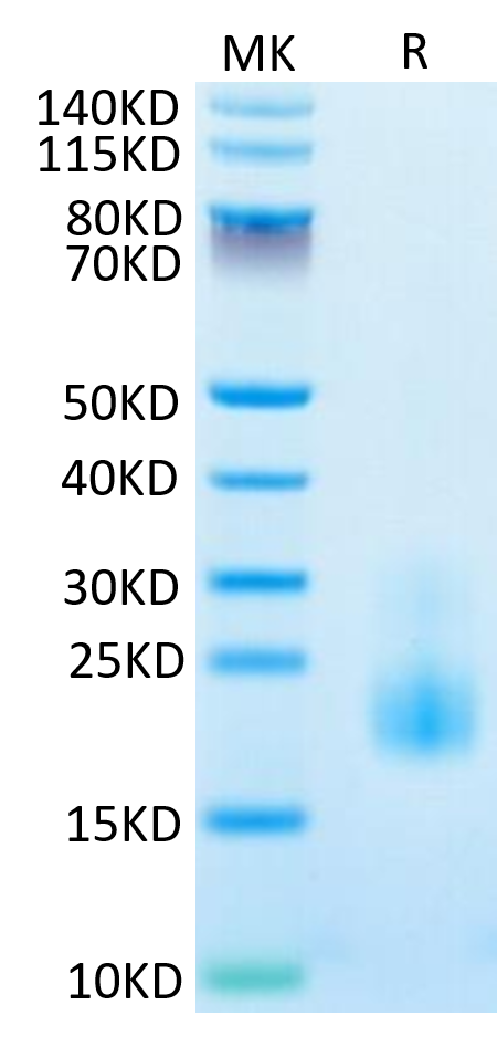 Cynomolgus/Rhesus macaque TIGIT on Tris-Bis PAGE under reduced condition. The purity is greater than 95%.Recombinant Cynomolgus/Rhesus macaque TIGIT Protein, Active