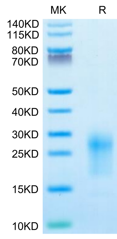 Mouse TIGIT on Tris-Bis PAGE under reduced condition. The purity is greater than 95%.Recombinant Mouse TIGIT Protein, Active