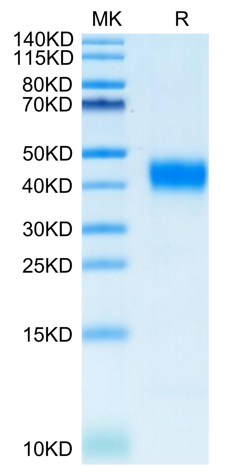 Cynomolgus CD38 on Tris-Bis PAGE under reduced condition. The purity is greater than 95%.Recombinant Cynomolgus CD38 Protein
