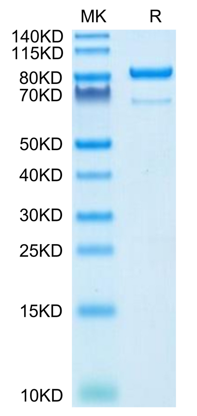 Human CD73 on Tris-Bis PAGE under reduced condition. The purity is greater than 95%.Recombinant Human CD73/NT5E Protein, Active