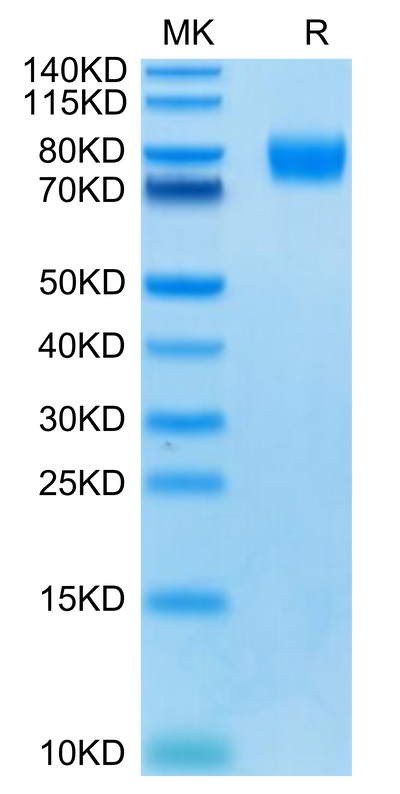 Human CD155 on Tris-Bis PAGE under reduced condition. The purity is greater than 95%.Recombinant Human CD155/PVR Protein, Active