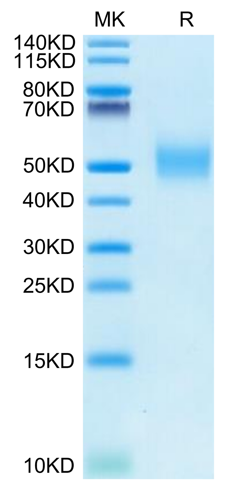 Rhesus macaque CD155/PVR on Tris-Bis PAGE under reduced condition. The purity is greater than 95%.Recombinant Rhesus macaque CD155/PVR Protein, Active