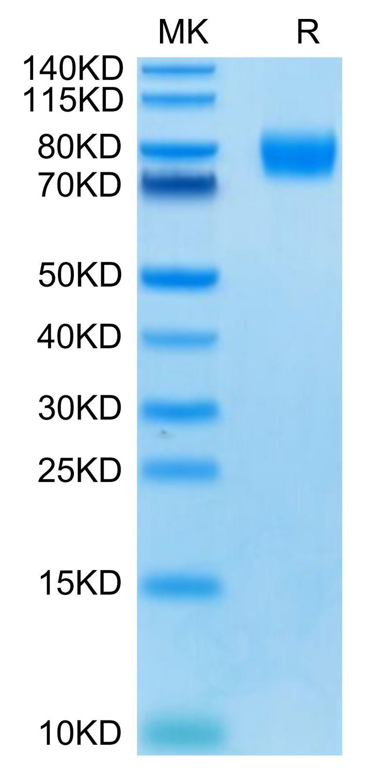 Human CD155 on Tris-Bis PAGE under reduced condition. The purity is greater than 95%.Recombinant Human CD155/PVR Protein, Active