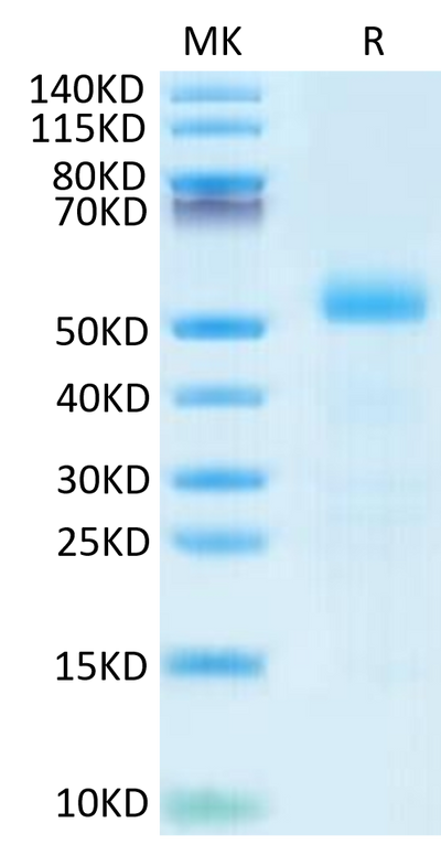 Mouse DLL3 on Tris-Bis PAGE under reduced- condition. The purity is greater than 95%.Recombinant Mouse DLL3 Protein, Active