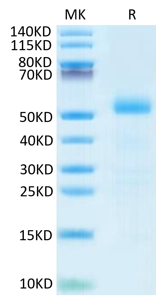 Mouse DLL3 on Tris-Bis PAGE under reduced- condition. The purity is greater than 95%.Recombinant Mouse DLL3 Protein, Active