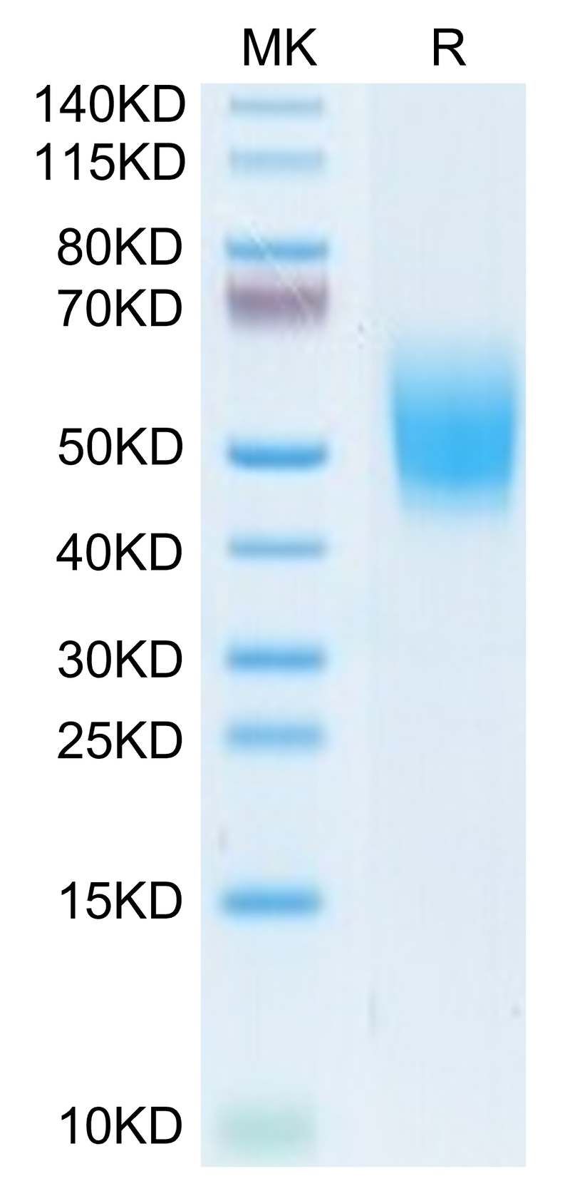 Cynomolgus DNAM-1 on Tris-Bis PAGE under reduced condition. The purity is greater than 95%.Recombinant Cynomolgus DNAM-1/CD226 Protein, Active