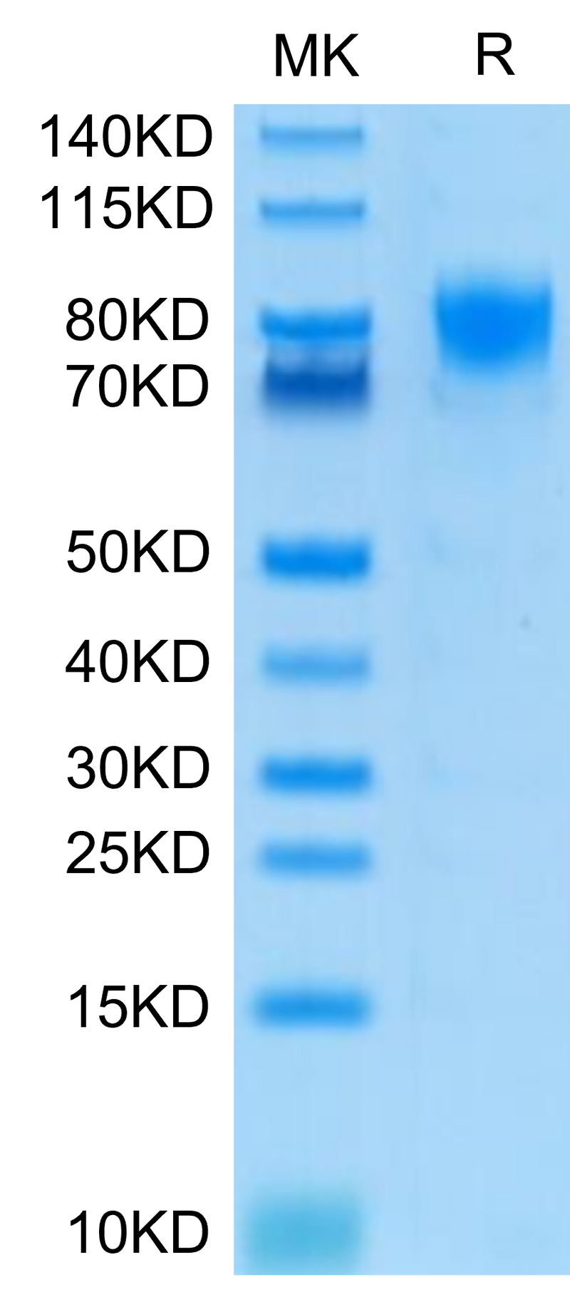 Human DNAM-1 on Tris-Bis PAGE under reduced condition. The purity is greater than 95%.Recombinant Human DNAM-1/CD226 Protein, Active