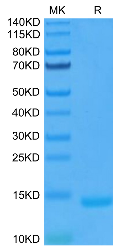 Human GM-CSF on Tris-Bis PAGE under reduced condition. The purity is greater than 95%.Recombinant Human GM-CSF Protein, Active