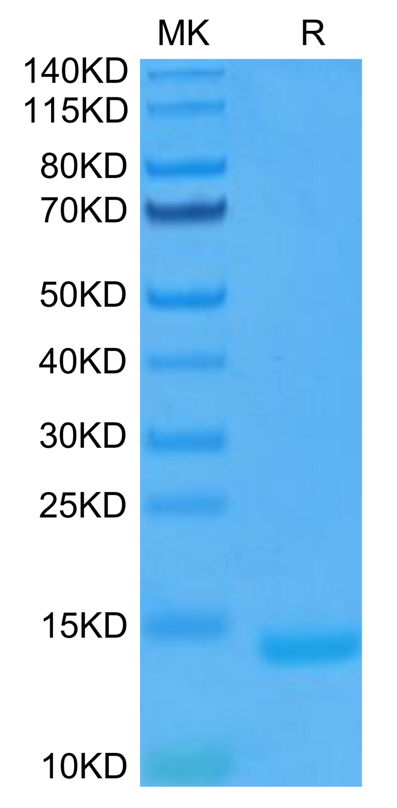 Human GM-CSF on Tris-Bis PAGE under reduced condition. The purity is greater than 95%.Recombinant Human GM-CSF Protein, Active
