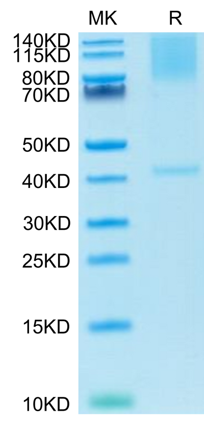 Cynomolgus GPC3 on Tris-Bis PAGE under reduced condition. The purity is greater than 95%.Recombinant Cynomolgus GPC3/Glypican 3 Protein, Active
