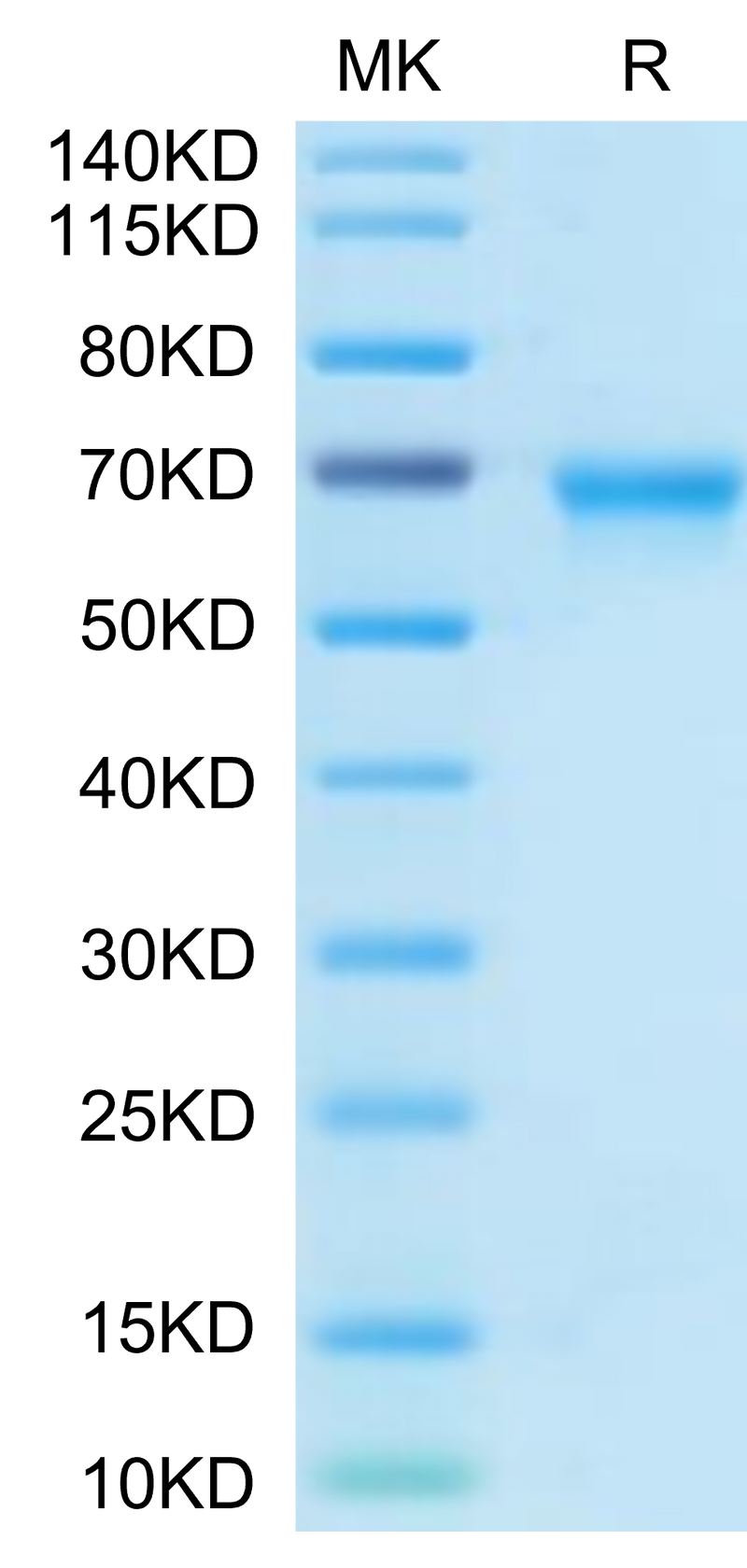 Biotinylated Human OX40 on Tris-Bis PAGE under reduced condition. The purity is greater than 95%.