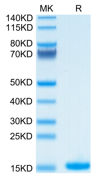 Human IL-2 on Tris-Bis PAGE under reduced condition. The purity is greater than 95%.Recombinant Human IL-2 Protein, Active