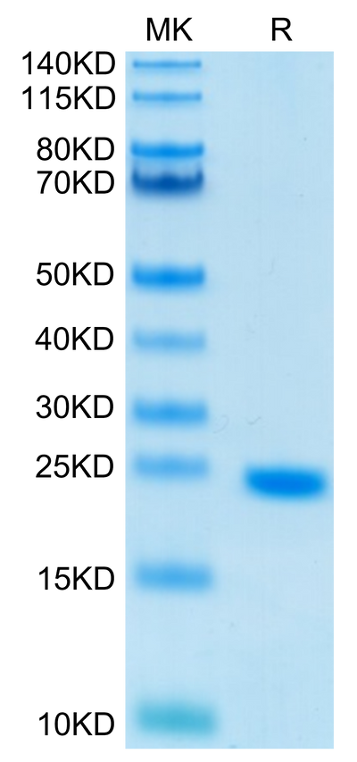 Human IL-6 on Tris-Bis PAGE under reduced condition. The purity is greater than 95%.Recombinant Human IL-6 Protein, Active