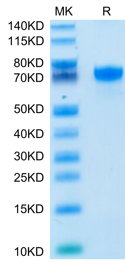 Human PD-L1 on Tris-Bis PAGE under reduced condition. The purity is greater than 95%.Recombinant Human PD-L1/B7-H1 Protein, Active