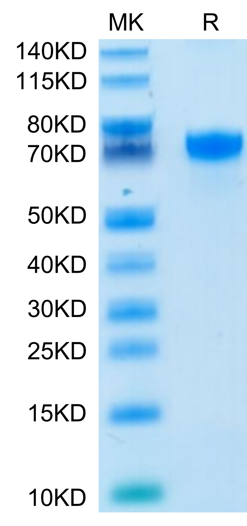 Human PD-L1 on Tris-Bis PAGE under reduced condition. The purity is greater than 95%.Recombinant Human PD-L1/B7-H1 Protein, Active