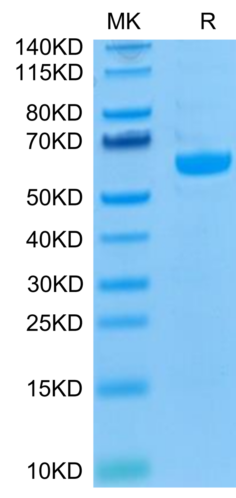 Biotinylated Human LAG3 on Tris-Bis PAGE under reduced condition. The purity is greater than 95%.Biotinylated Human LAG3/CD223 Protein, Active