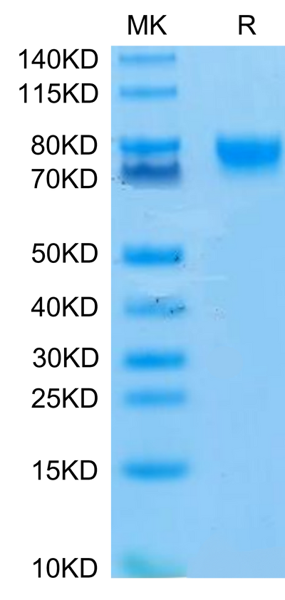 Human IL-4 R alpha on Tris-Bis PAGE under reduced condition. The purity is greater than 95%.Recombinant Human IL-4 R alpha/CD124 Protein, Active