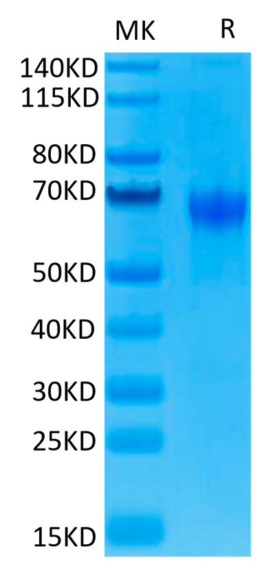 Human PD-1 on Tris-Bis PAGE under reduced. The purity is greater than 95%.Recombinant Human PD-1/PDCD1 Protein, Active