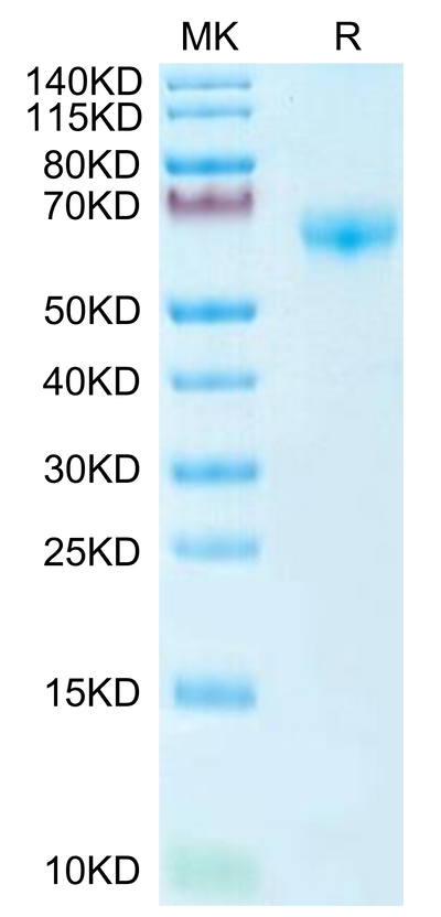 Mouse PD-1 on Tris-Bis PAGE under reduced condition. The purity is greater than 95%.Recombinant Mouse PD-1/PDCD1 Protein, Active