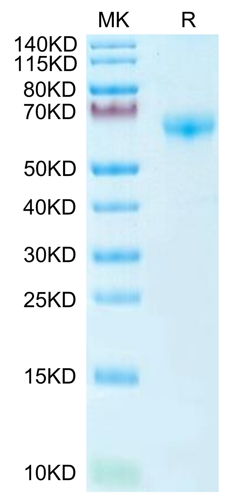 Mouse PD-1 on Tris-Bis PAGE under reduced condition. The purity is greater than 95%.Recombinant Mouse PD-1/PDCD1 Protein, Active