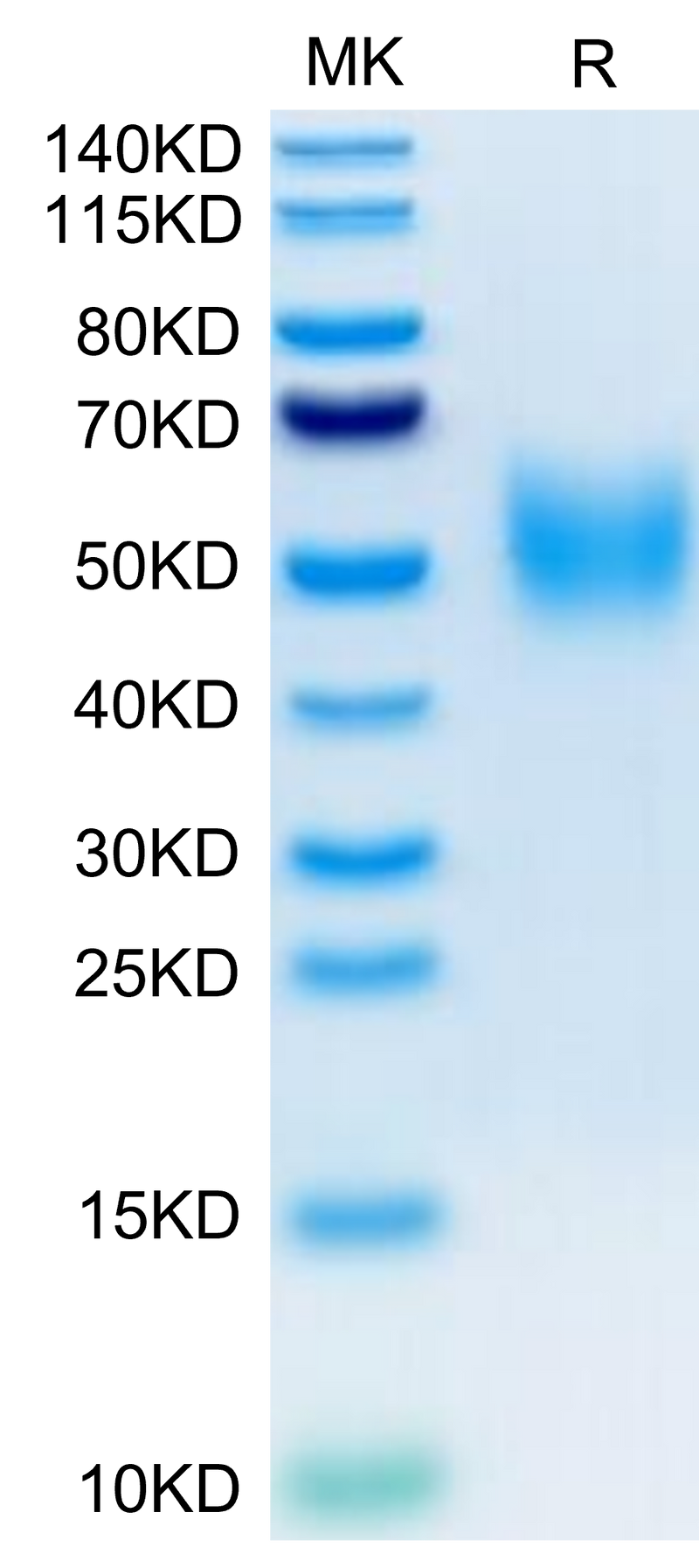 Biotinylated Human 2B4 on Tris-Bis PAGE under reduced condition. The purity is greater than 95%.Biotinylated Human 2B4/CD244/SLAMF4 Protein, Active