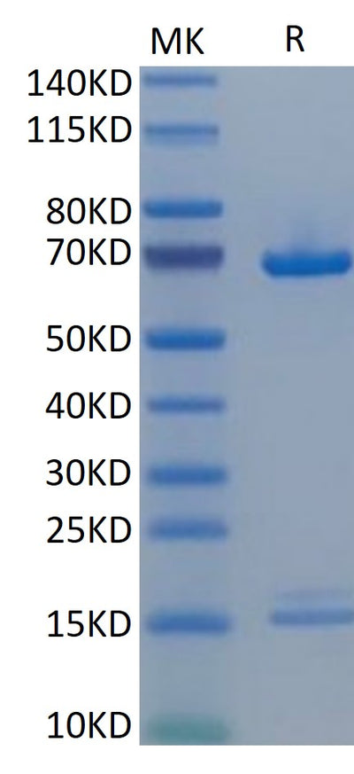 Human PCSK9 on Tris-Bis PAGE under reduced condition. The purity is greater than 95%.Recombinant Human PCSK9 Protein, Active