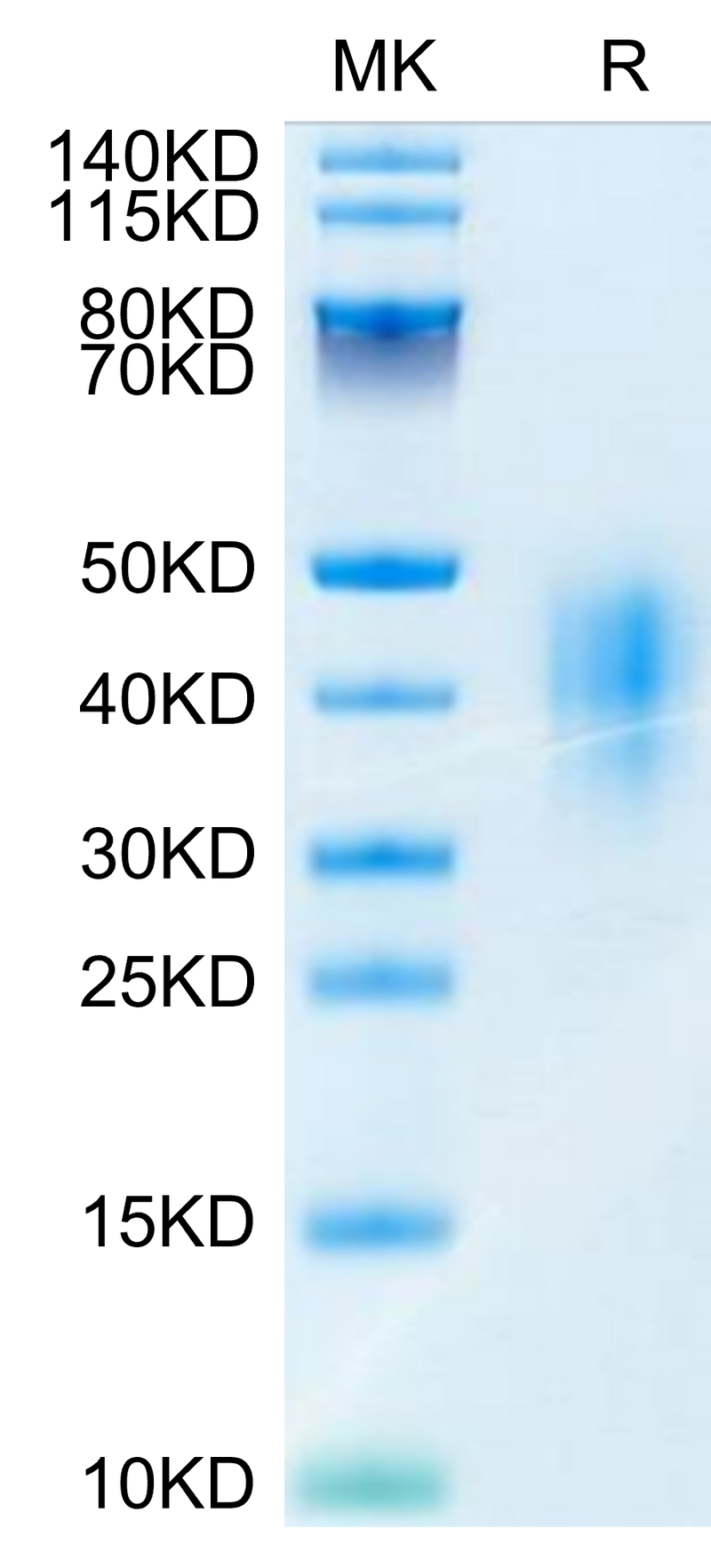 Mouse CD47 on Tris-Bis PAGE under reduced condition. The purity is greater than 95%.Recombinant Mouse CD47 Protein, Active