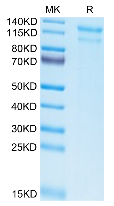 Biotinylated Human LDLR on Tris-Bis PAGE under reduced condition. The purity is greater than 95%.Biotinylated Human LDLR Protein, Active