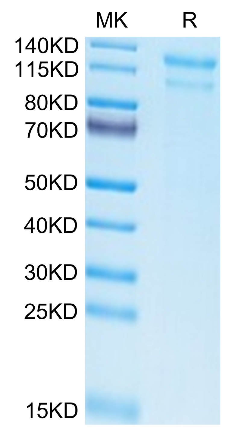 Biotinylated Human LDLR on Tris-Bis PAGE under reduced condition. The purity is greater than 95%.Biotinylated Human LDLR Protein, Active